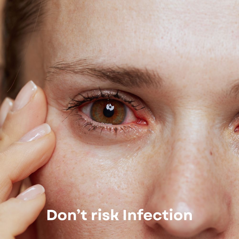 Infected eye (looks red and puffy) after DIY kit used for lifted lashes for holidays
